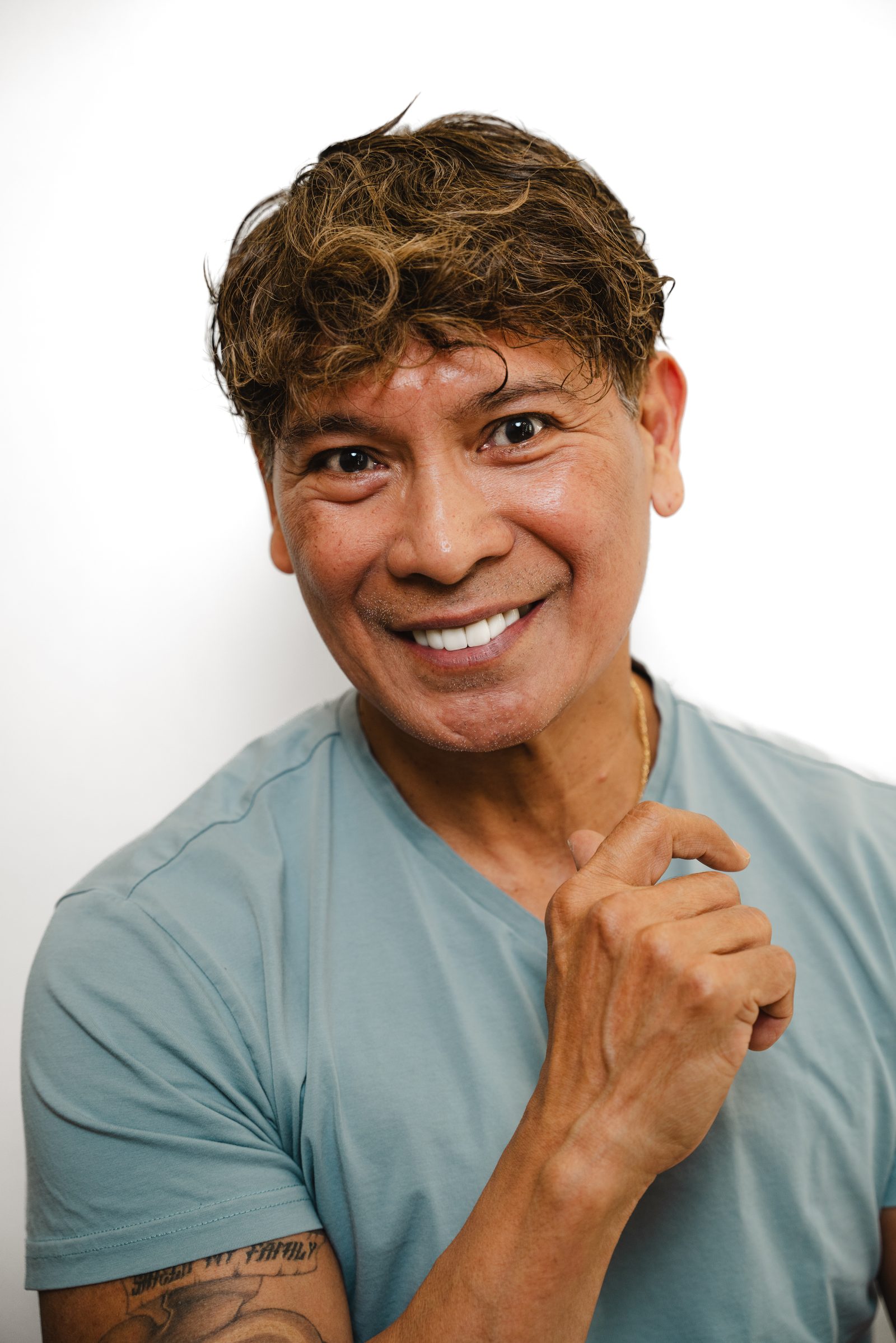Dental Bridges patient at Vegas Choice Dental in Las Vegas